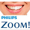 Blanqueamiento ZOOM® (Philips)