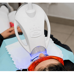 Blanqueamiento ZOOM® (Philips) – 8 tonos más blanco en 1 sesión