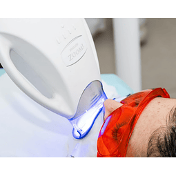 Higiene + Blanqueamiento ZOOM® (Philips)