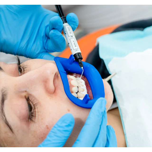 Blanqueamiento ZOOM® (Philips) – 8 tonos más blanco en 1 sesión