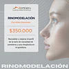 Rhinomodelling