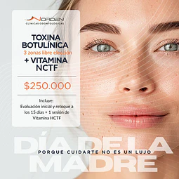 Toxina Botulínica + Sesión de Mesoterapia NCTF