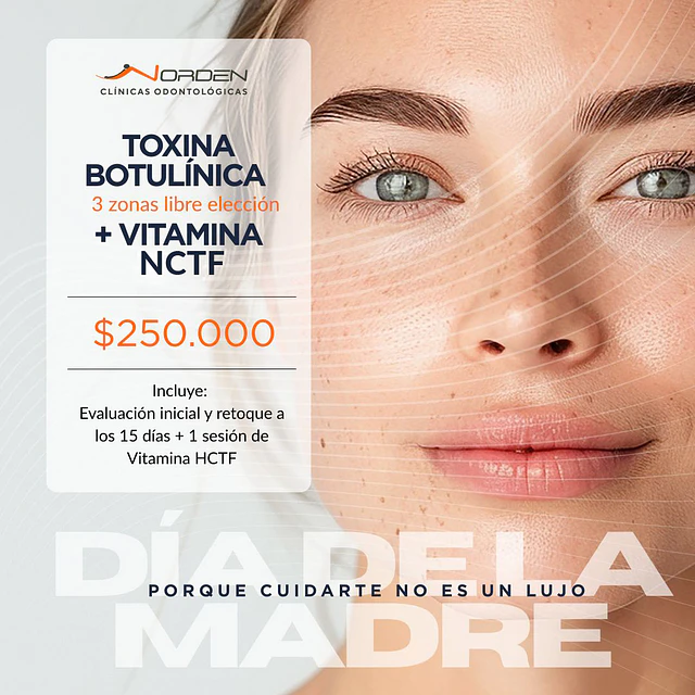 Toxina Botulínica + Sesión de Mesoterapia NCTF