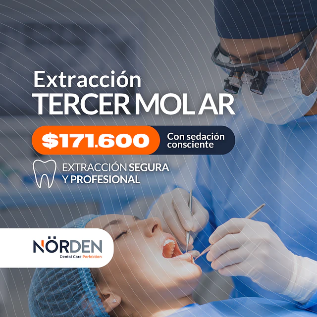 Extracción tercer molar con Óxido Nitroso