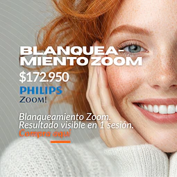 Blanqueamiento ZOOM® (Philips) – 8 tonos más blanco en 1 sesión