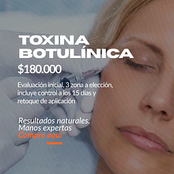 Toxina Botulínica – Zonas a elección + retoque incluido