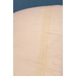 Penso para perdas de urina moderadas a severas