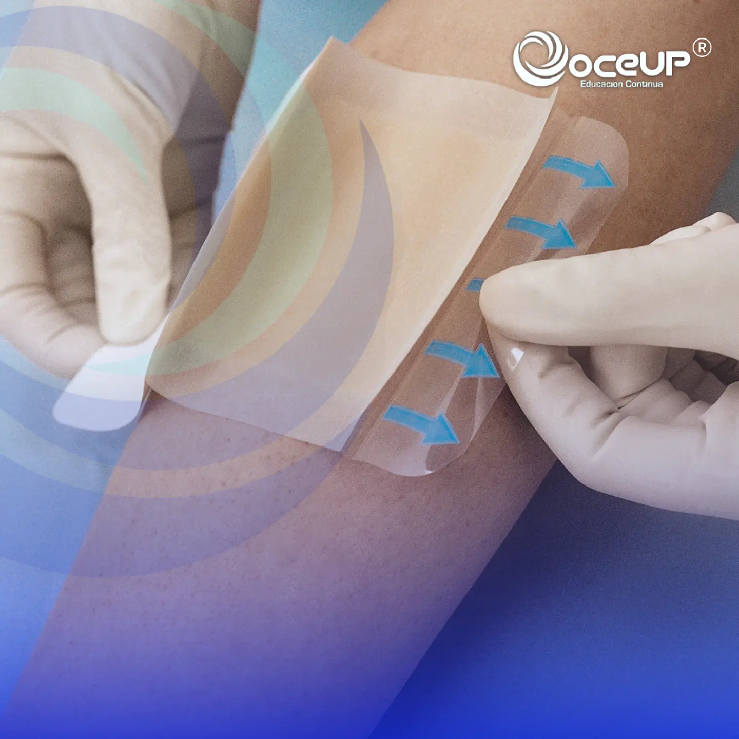 Diplomado en Manejo Avanzado de Heridas y Prevención de UPP 280 Hrs. 1