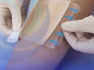 Diplomado en Manejo Avanzado de Heridas y Prevención de UPP 280 Hrs.