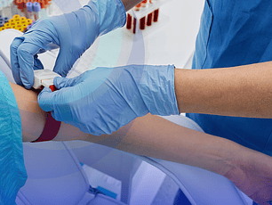 Toma de Muestra Sanguínea, 21 Hrs.