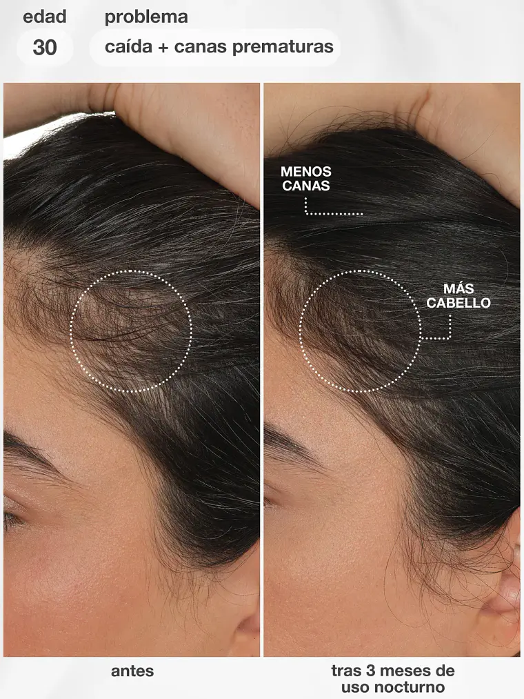 FutureIQ - Serum de longevidad capilar K18 2