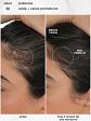 FutureIQ - Serum de longevidad capilar K18 - Miniatura 2