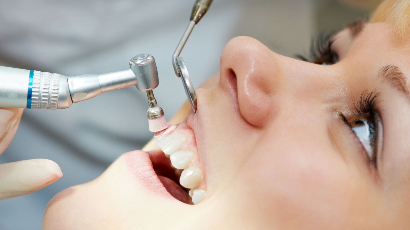 ¿Qué es la Profilaxis Dental?