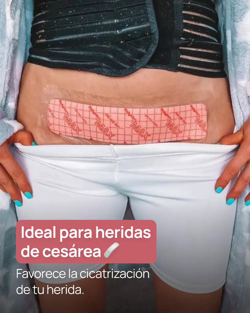 Polymen Apósito Post Parto 5*26 2