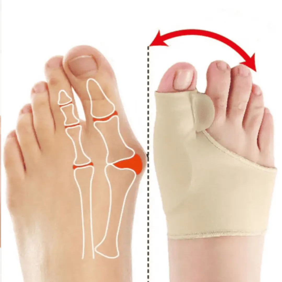 Corrector de Juanetes 4