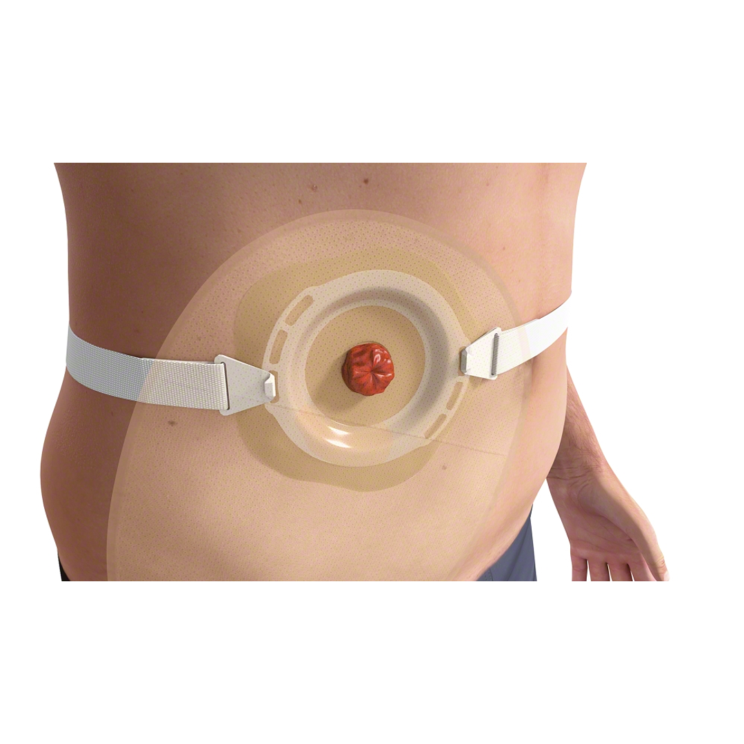  Cinturon Colostomia Ally Belt BBraun — 5028  3