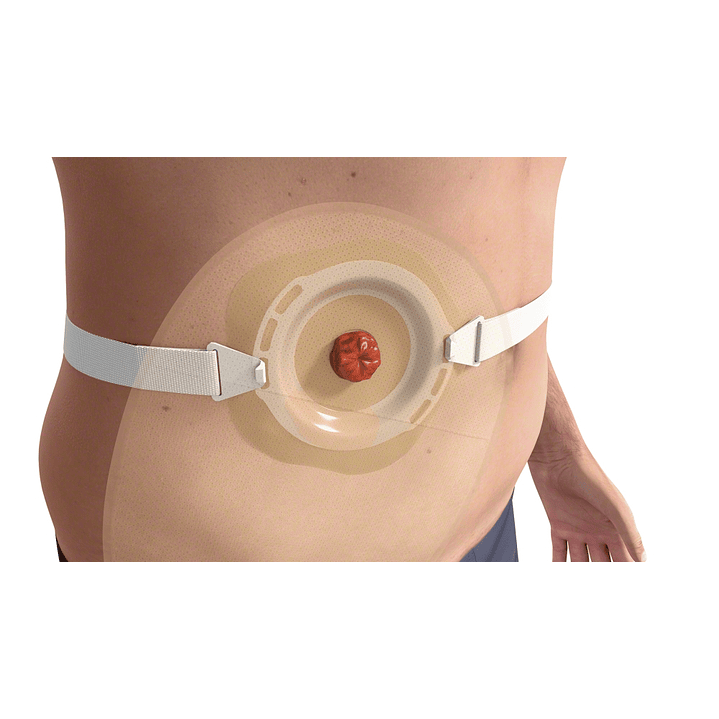  Cinturon Colostomia Ally Belt BBraun — 5028  3