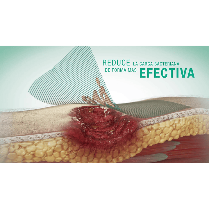  Apósito antimicrobiano — CUTIMED SORBACT — 10x10 cm 72162-00  3