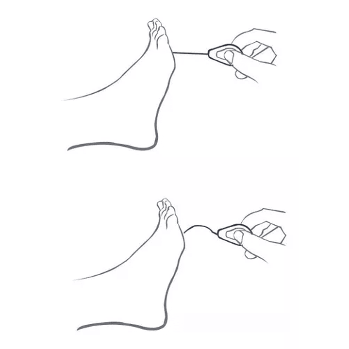 Monofilamento – Pie diabético 2