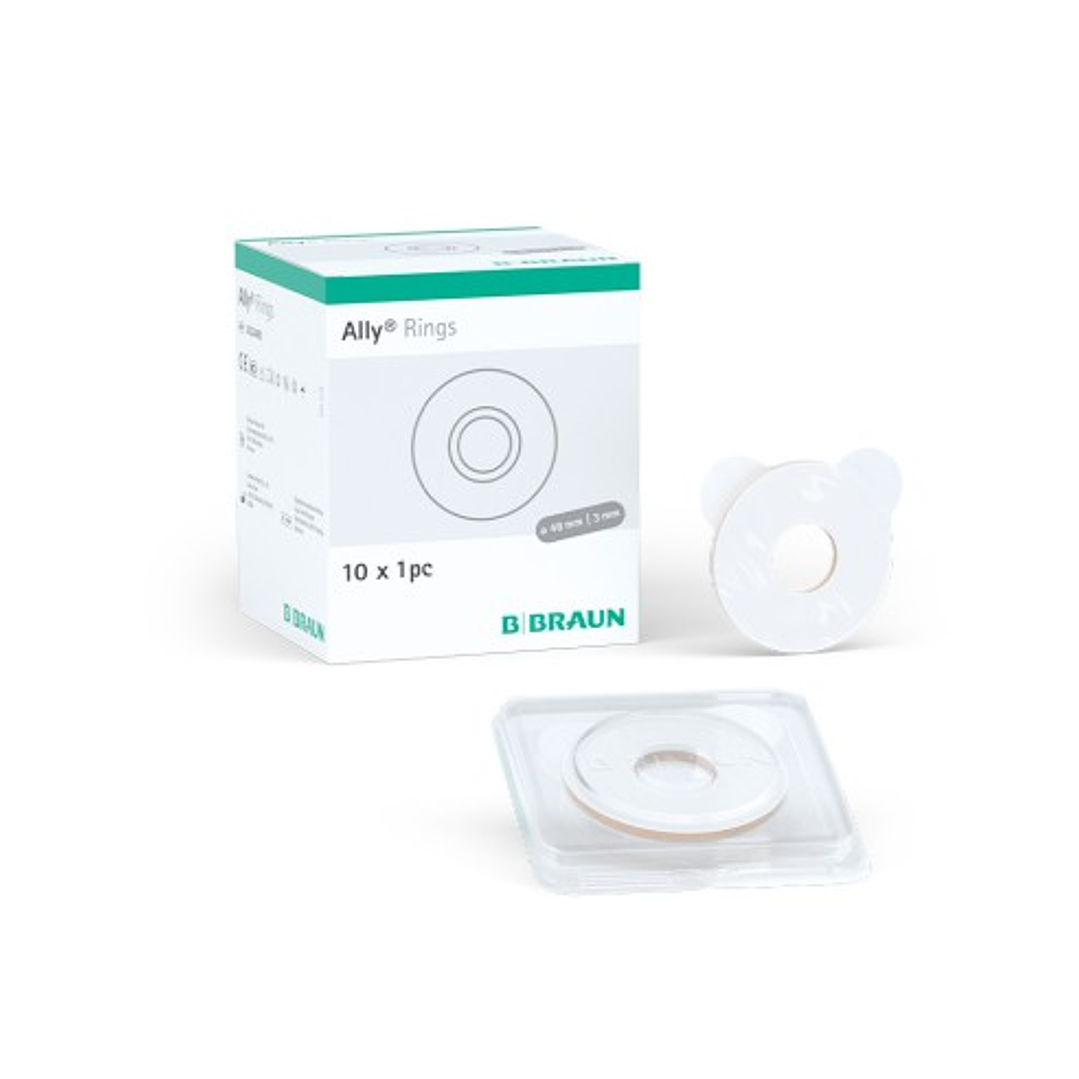 Anillo Hidrocoloide Ally Rings 48-3mm - 2022483 1