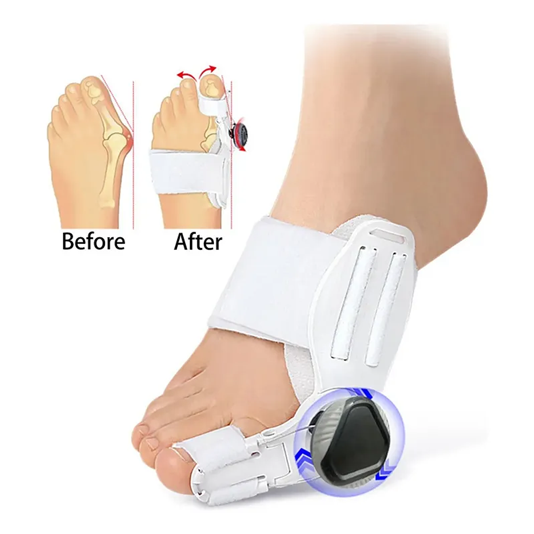 Corrector de Juanete Reegulable - FeetiFix 1