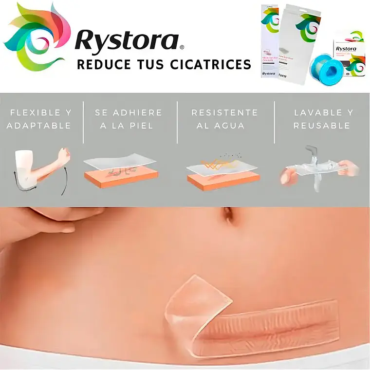 ROLLO DE SILICONA PARA CICATRICES 2.5CMX1.5M RYSTORA 2