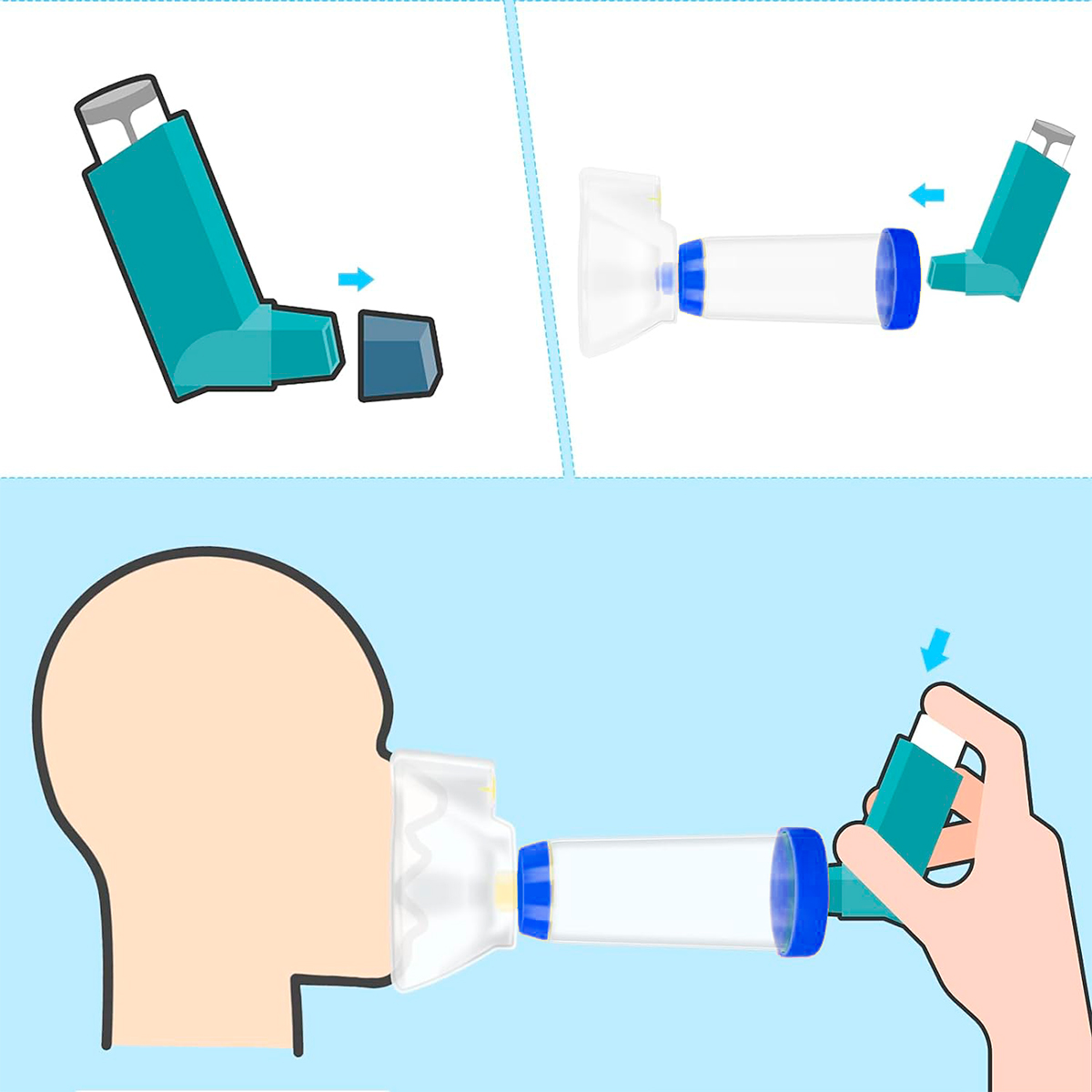 Cámara Inhaladora (inhalocamara) Pediatrica