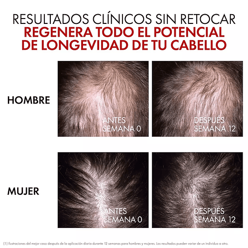 VICHY Dercos REGEN Booster Sérum Anticaída 90ml 7