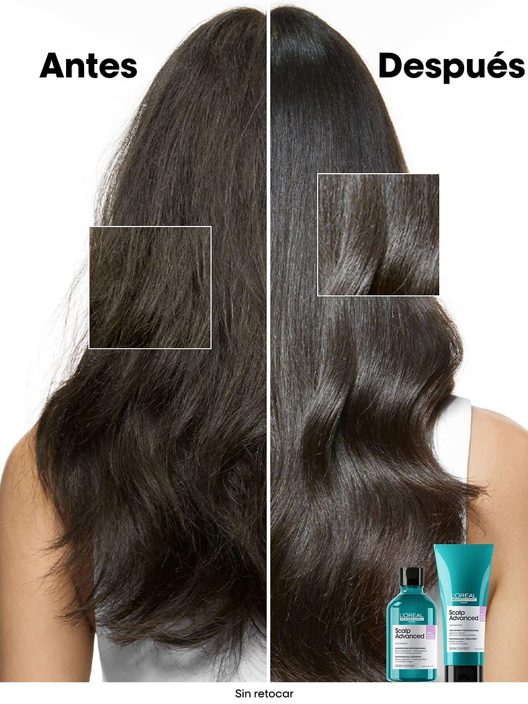 L'Oréal Professionnel Serie Expert Scalp Advanced Anti-Discomfort Shampoo 300ml  3