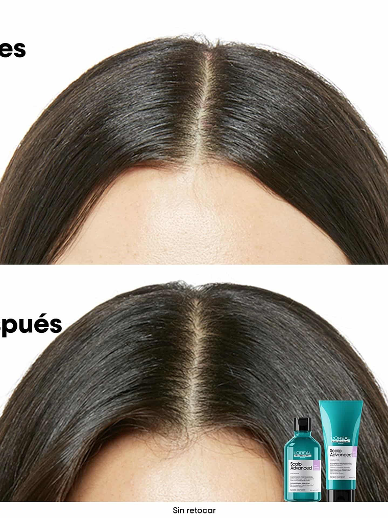 L'Oréal Professionnel Serie Expert Scalp Advanced Anti-Discomfort Shampoo 300ml  4