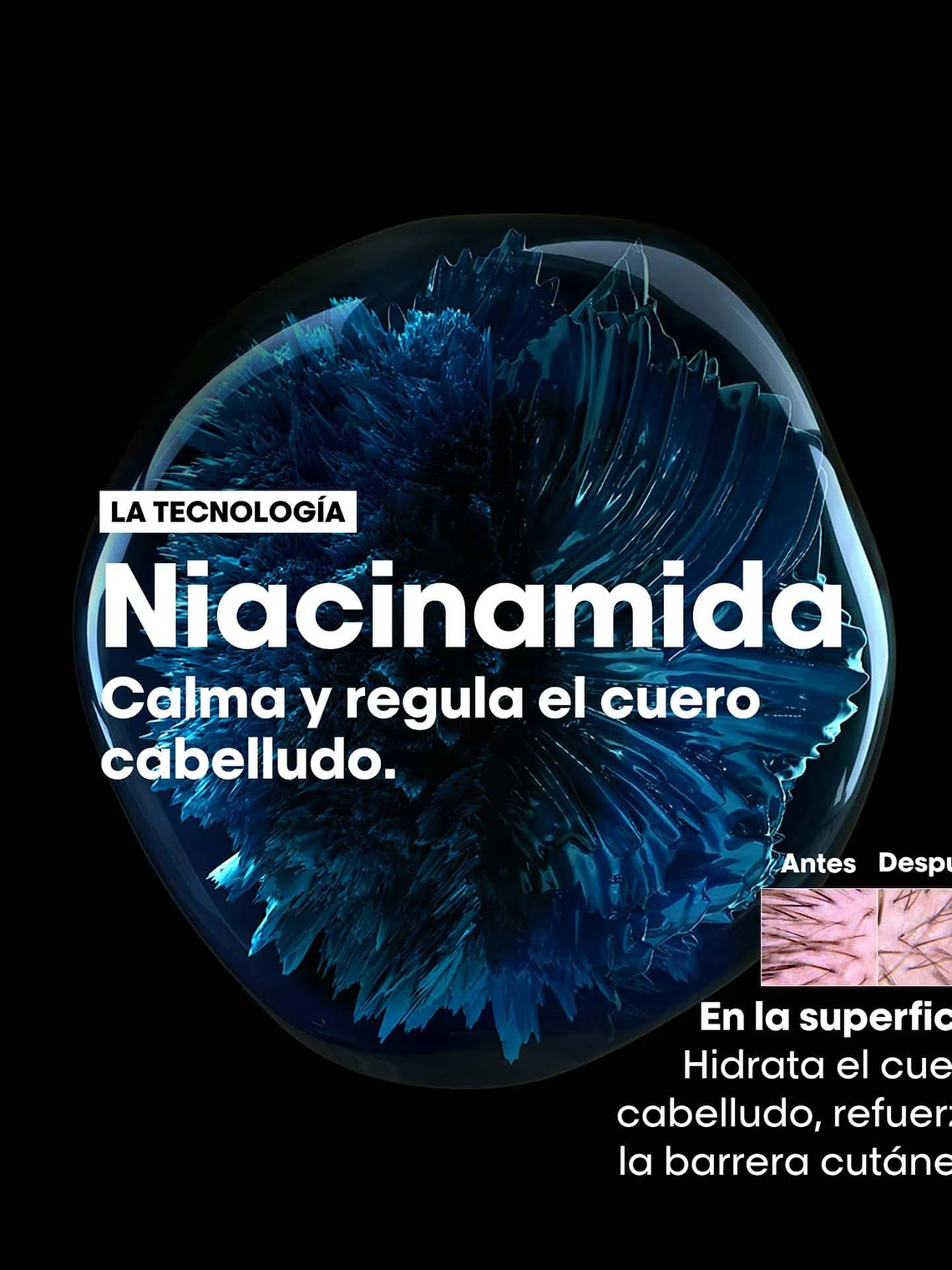 L'Oréal Professionnel Serie Expert Scalp Advanced Anti-Discomfort Shampoo 300ml  5