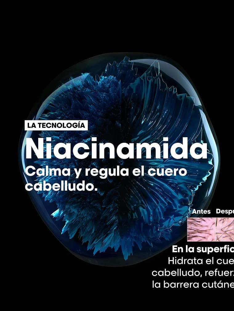 L'Oréal Professionnel Serie Expert Scalp Advanced Anti-Discomfort Shampoo 300ml  5