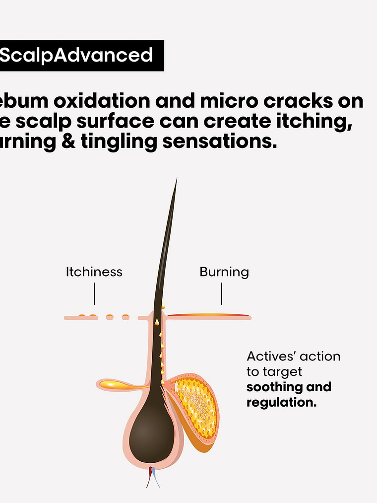 L'Oréal Professionnel Serie Expert Scalp Advanced Anti-Discomfort Treatment 200ml 6