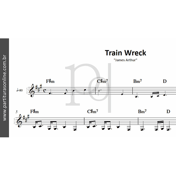 Train Wreck | James Arthur 2