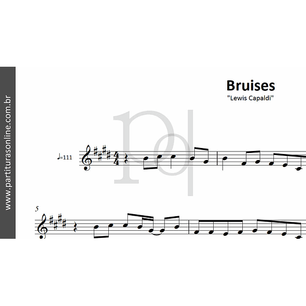 Bruises | Lewis Capaldi 2