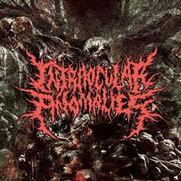 Intraocular Anomalies - Promo CD