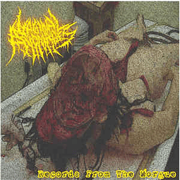 Vaginal Anomalies ‎– Archives From The Morgue CD
