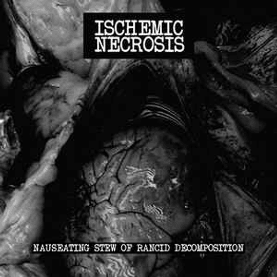 Ischemic Necrosis ‎– Nauseating Stew Of Rancid Decomposition CD