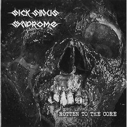 Sick Sinus Syndrome – Rotten To The Core CD