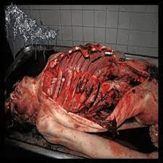 Massive Gore Bulge- The Surreal Pleasures---DIGIPROCDR