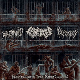 Anal Stabwound/ Carnifloor/ Gorec+nt CD