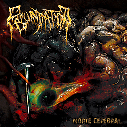 Fecundation – Morte Cerebral MCD