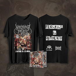 Naegleria Fowleri -Dissolved In...  CD + T-SHIRT SIZE XL 