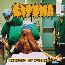 Lipoma – Horrors of Pathology CD