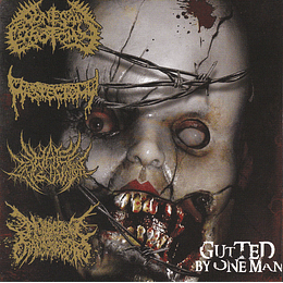 Bonesaw Lobotomy / Mastectomy / Hate Inclination / Numbered With The Transgressors – Gutted By One Man CD