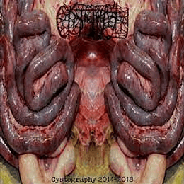 Cystgurgle – Cystography 2014-2018 CD