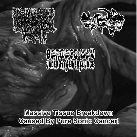 Submersed In Infected Medical Waste / Miastenia Gravis / Garbage Man Under the Sewersludge – Massive Tissue Breakdown Caused By Pure Sonic Cancer! CDR