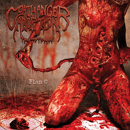 Coathanger Abortion  – Plan C CD