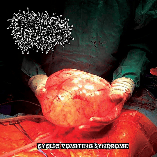 Foetal Fluids To Expurgate – Cyclic Vomiting Syndrome CD