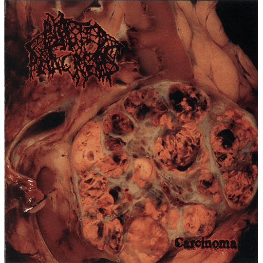 Blasted Pancreas – Carcinoma LP